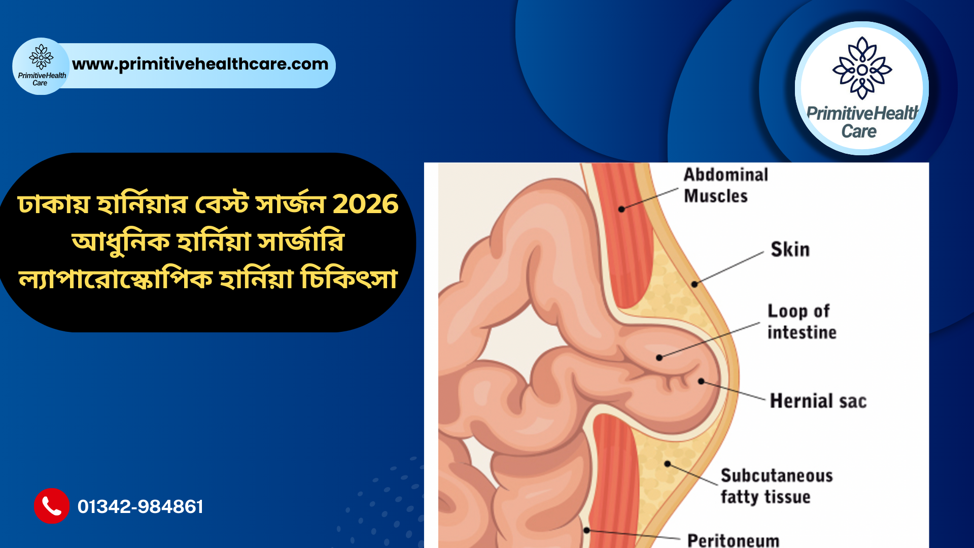 Best Hernia Surgeon in Dhaka 2026